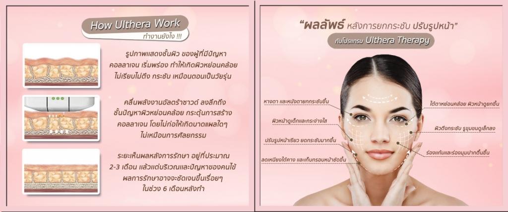 Ulthera หมอโบ เดอโบคลินิค