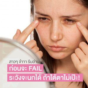 วิธีเช็คอาการก่อน ฉีดฟิลเลอร์ใต้ตา ตาแบบไหนควรฉีดฟิลเลอร์