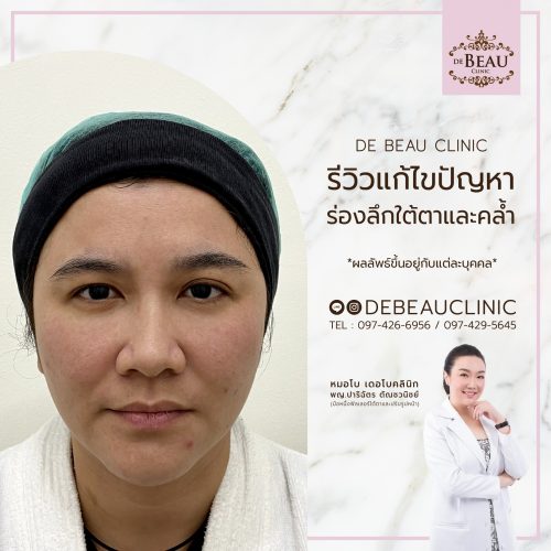 รีวิวหมอโบ เดอโบคลินิก