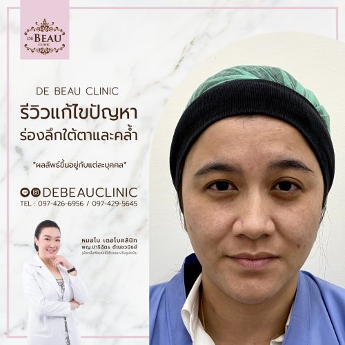 รีวิวหมอโบ เดอโบคลินิก