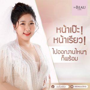 สวยฉบับเร่งด่วน หน้าเป๊ะ หน้าเรียว สวยสั่งได้ เดอโบคลินิก หมอโบ