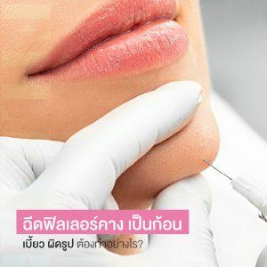 ฉีดฟิลเลอร์คาง เป็นก้อน