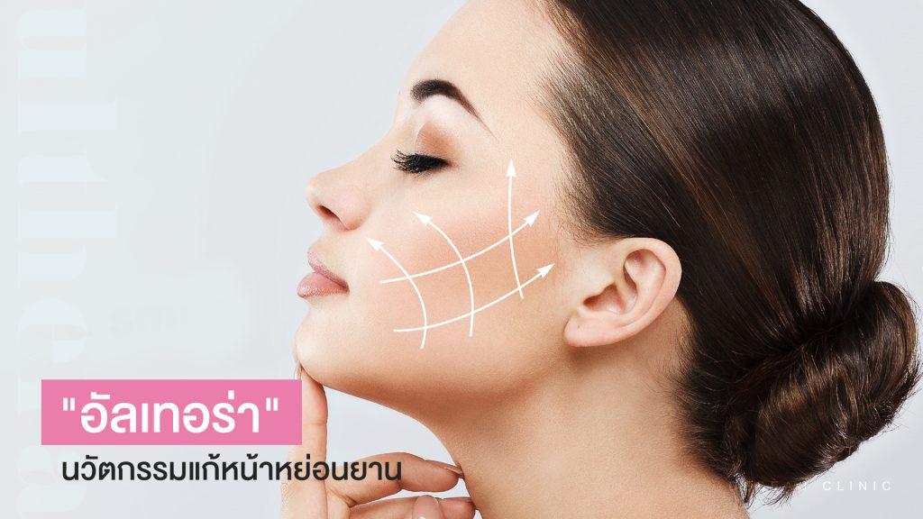 "อัลเทอร่า" Ulthera นวัตกรรมแก้ปัญหาผิวหน้าหย่อน ช่วยผ่อนเหนียง