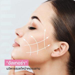 "อัลเทอร่า" Ulthera นวัตกรรมแก้ปัญหาผิวหน้าหย่อน ช่วยผ่อนเหนียง
