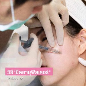 5 วิธียืดอายุฟิลเลอร์ เคล็ดลับการรักษาฟิลเลอร์ให้อยู่นานๆ