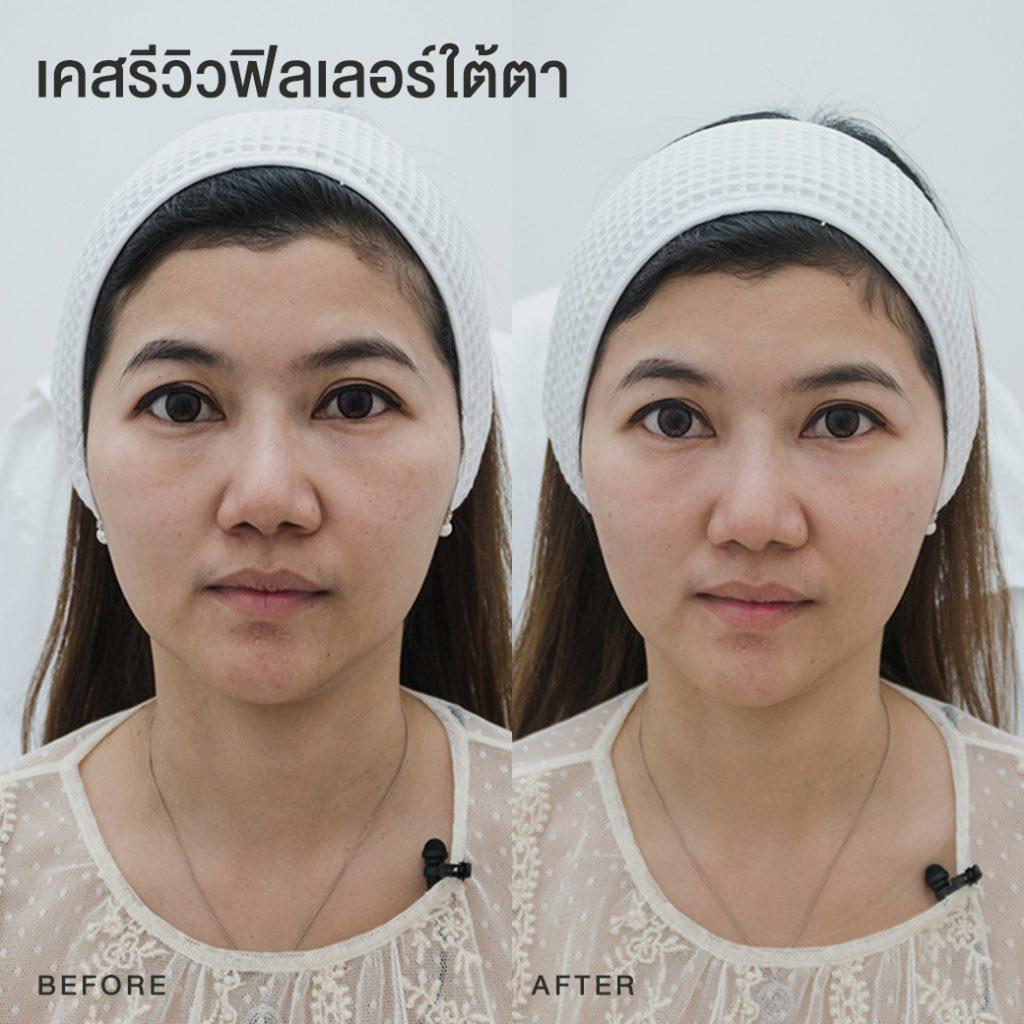My Image 31