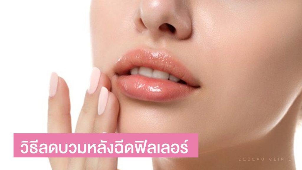 วิธีลดบวมช้ำ หลังฉีดฟิลเลอร์