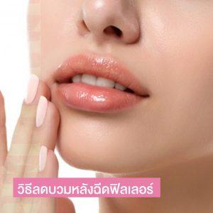 วิธีลดบวมหลังฉีดฟิลเลอร์