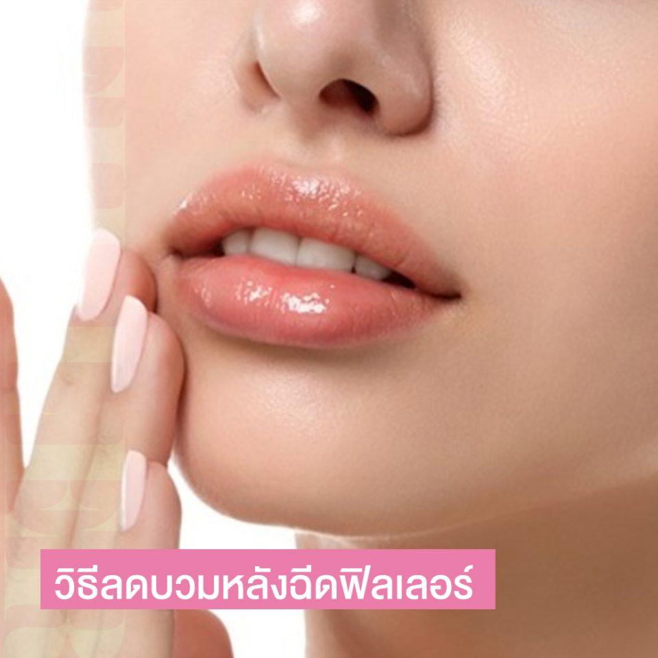 My Image 38