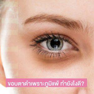 ขอบตาดำเพราะภูมิแพ้ ทำยังไงดี