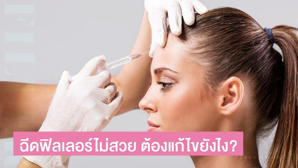 ฉีดฟิลเลอร์เป็นก้อน เป็นคลื่น ฉีดฟิลเลอร์แล้วไม่สวย ทำยังไง