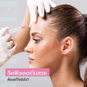 ฉีดฟิลเลอร์เป็นก้อน เป็นคลื่น ฉีดฟิลเลอร์แล้วไม่สวย ทำยังไง