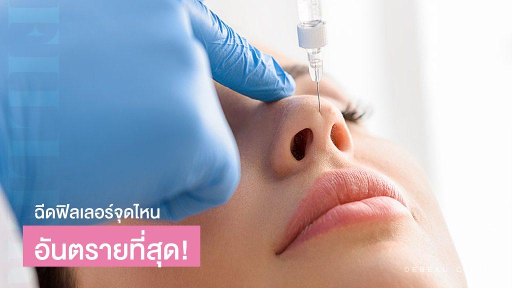 4 จุดฉีดฟิลเลอร์ อันตราย ก่อนฉีดต้องคิดให้หนัก!