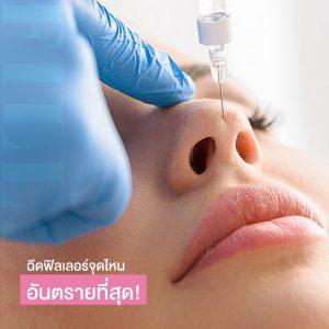 4 จุดฉีดฟิลเลอร์ อันตราย ก่อนฉีดต้องคิดให้หนัก!