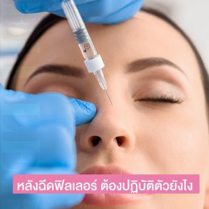 หลังฉีดฟิลเลอร์ ต้องปฏิบัติตัวยังไง