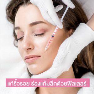 ร่องแก้มลึก แก้ริ้วรอยร่องแก้ม แก้มหย่อนคล้อยด้วยฟิลเลอร์