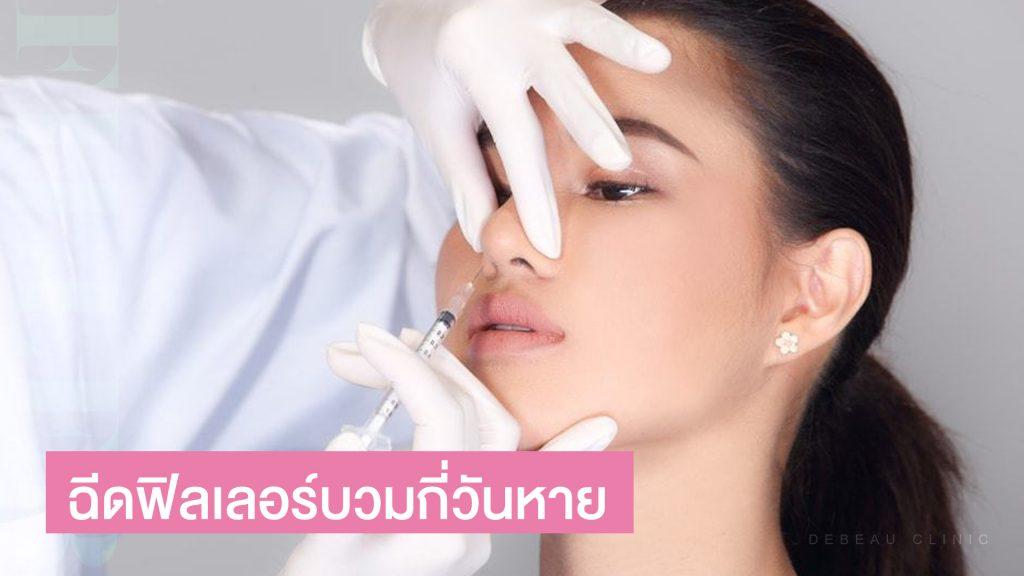 ฉีดฟิลเลอร์บวมกี่วันหาย