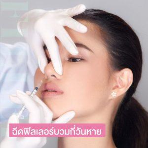 ฉีดฟิลเลอร์บวมกี่วันหาย