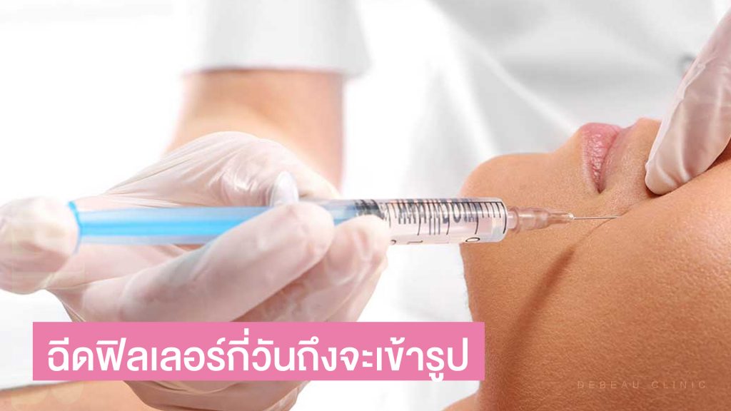 ฉีดฟิลเลอร์กี่วันเข้าที่ กี่วันถึงจะเข้ารูป สวยเป๊ะทุกองศา!