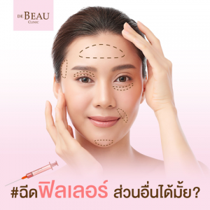 ฟิลเลอร์ ฉีดส่วนอื่นได้มั้ย?