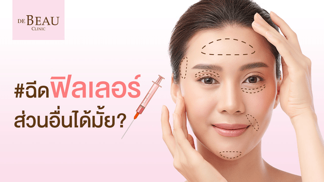 ฟิลเลอร์ ฉีดส่วนอื่นได้มั้ย?