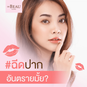 ฉีดปากอันตรายมั้ย? ต้องเตรียมตัวอย่างไร ใครควรฉีด "ฟิลเลอร์ปาก"