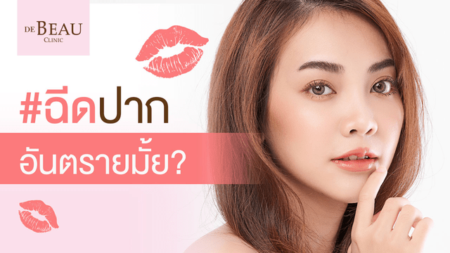 ฉีดปากอันตรายมั้ย? ต้องเตรียมตัวอย่างไร ใครควรฉีด "ฟิลเลอร์ปาก"