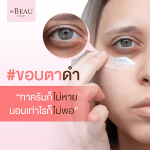 ขอบตาดำ ทาครีมก็ไม่หาย นอนเท่าไรก็ไม่พอ