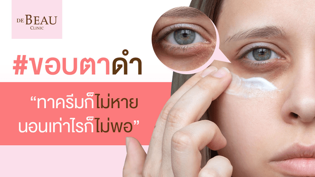 ขอบตาดำ ทาครีมก็ไม่หาย นอนเท่าไรก็ไม่พอ