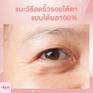 แนะ 6 วิธีลดริ้วรอยใต้ตา ทั้งรอยเหี่ยว รอยคล้ำ แบบได้ผล 100%