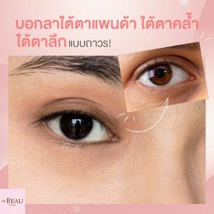 4 วิธีบอกลาใต้ตาแพนด้า ใต้ตาคล้ำ ใต้ตาลึก แบบถาวร!