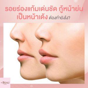 รอยร่องแก้มเด่นเห็นชัด กู้หน้าย่นเป็นหน้าเด้ง ต้องทำยังไง