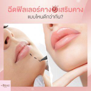 ฉีดฟิลเลอร์คาง VS เสริมคาง แบบไหนดีกว่ากัน