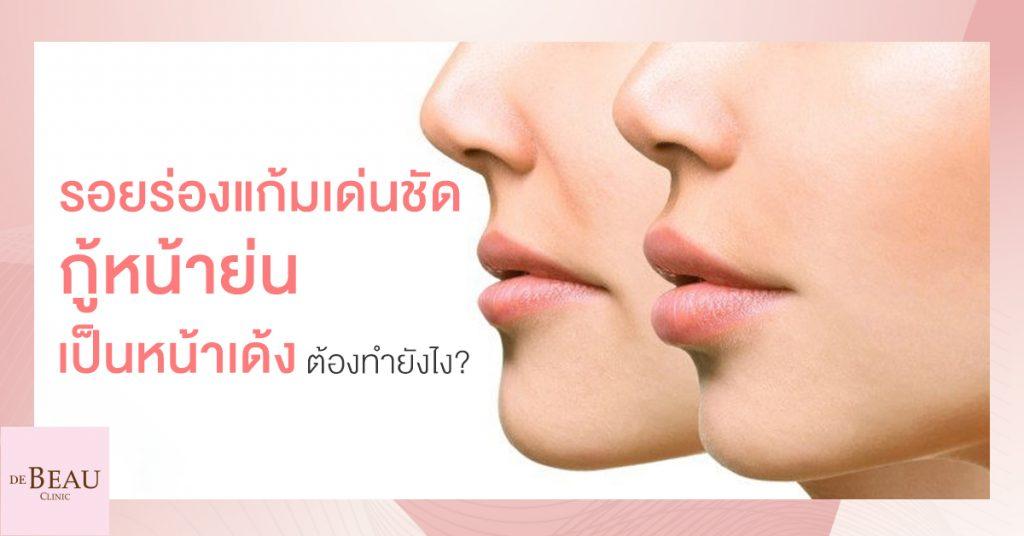 รอยร่องแก้มเด่นเห็นชัด กู้หน้าย่นเป็นหน้าเด้ง ต้องทำยังไง