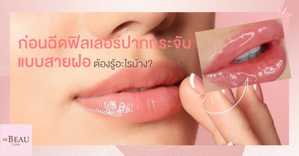 ก่อนฉีดฟิลเลอร์ปากกระจับแบบสายฝอ ต้องรู้อะไรบ้าง 