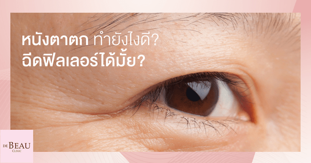 หนังตาตก คิ้วตก ใบหน้าล้า แก้ปัญหาด้วยฟิลเลอร์ดีมั้ย