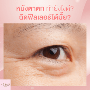 หนังตาตก คิ้วตก ใบหน้าล้า แก้ปัญหาด้วยฟิลเลอร์ดีมั้ย