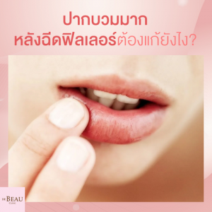 ปากบวมมากหลังฉีดฟิลเลอร์ ต้องแก้ยังไง?