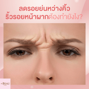 ลดรอยย่นหว่างคิ้ว ริ้วรอยหน้าผาก ทำยังไง?