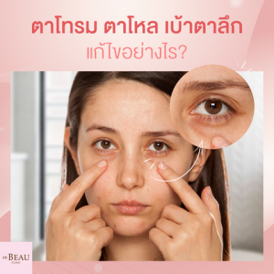 ตาโทรม ตาโหล เบ้าตาลึก ควรแก้ไขอย่างไร ใช้วิธีไหนดีที่สุด?