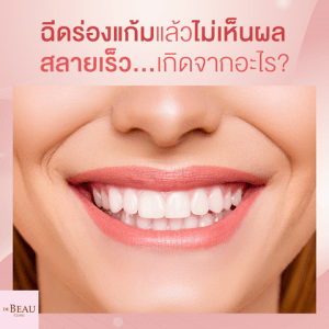ฉีดร่องแก้มแล้วไม่เห็นผล สลายเร็ว เกิดจากอะไร?