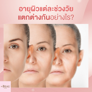 อายุผิวแต่ละช่วงวัย แตกต่างกันอย่างไร