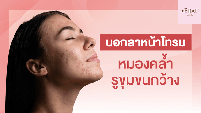 บอกลาหน้าโทรม หมองคล้ำ รูขุมขนกว้าง 