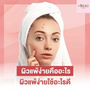 ผิวแพ้ง่ายคืออะไร ผิวแพ้ง่ายใช้อะไรดี