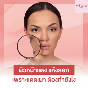 ใบหน้าแสบ ผิวหน้าแห้งลอก เพราะแดดเผา ต้องทำยังไง