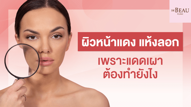ใบหน้าแสบ ผิวหน้าแห้งลอก เพราะแดดเผา ต้องทำยังไง