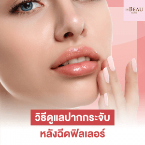 วิธีดูแลปากกระจับหลังฉีดฟิลเลอร์