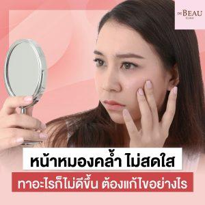 หน้าหมองคล้ำ