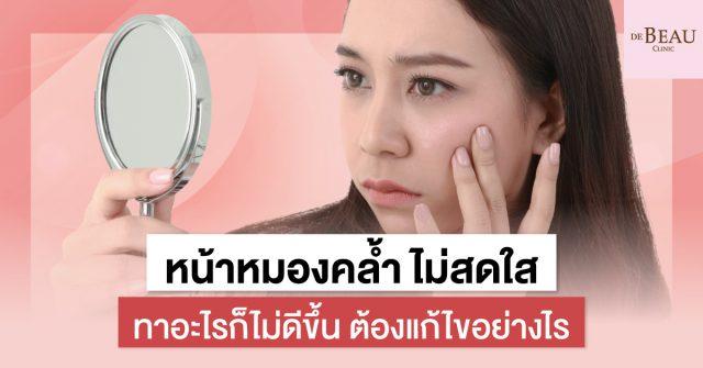 หน้าหมองคล้ำ