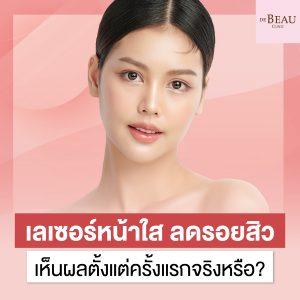 เลเซอร์หน้าใส ลดรอยสิว เห็นผลตั้งแต่ครั้งแรกจริงหรือ?